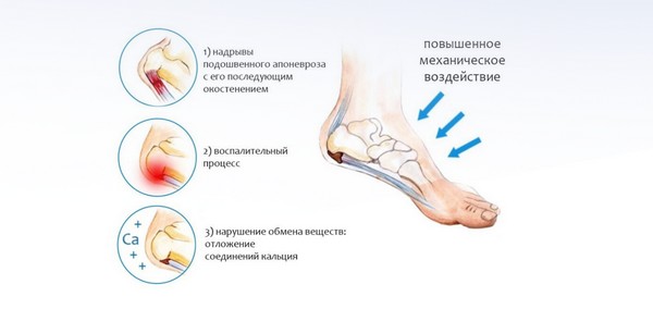Ушиб ноги - симптомы, причины и лечение | «СМ-Клиника»